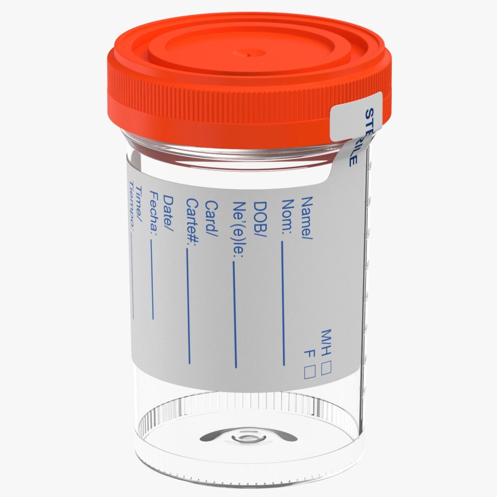 50 ML URINE CONTAINER ( STERILZED) - Pinacal Exim